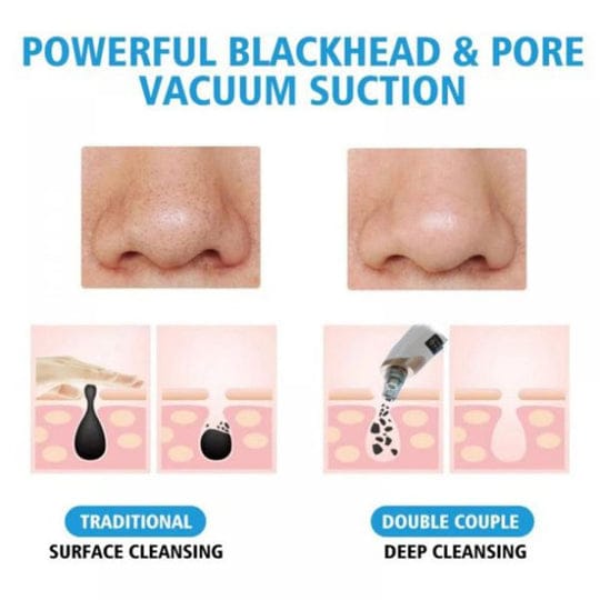 ELECTRIC SUCTION BLACKHEAD INSTRUMENT BLACKHEAD PORE CLEANING - MONAFY